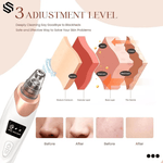 5-i-1 Blackhead Remover™ | Vakuumbaserad pormaskaremover